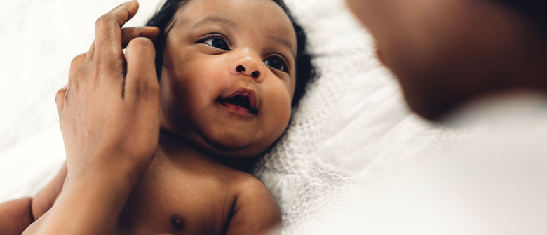 Causes of Milk Rash - Cussons Baby Nigeria