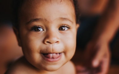 How to Identify and Prevent / Treat Heat Rash in Babies